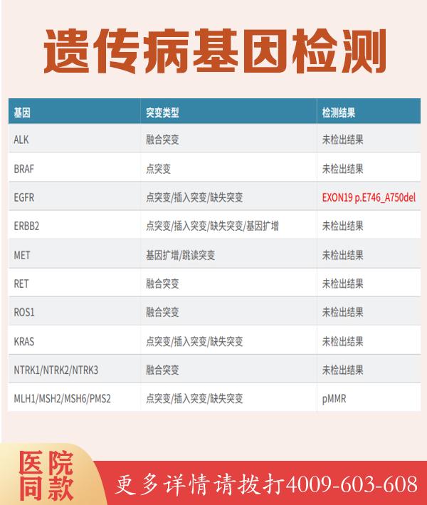 hiv抗体检测价格如何？从8QQ健康网的角度为您解析
